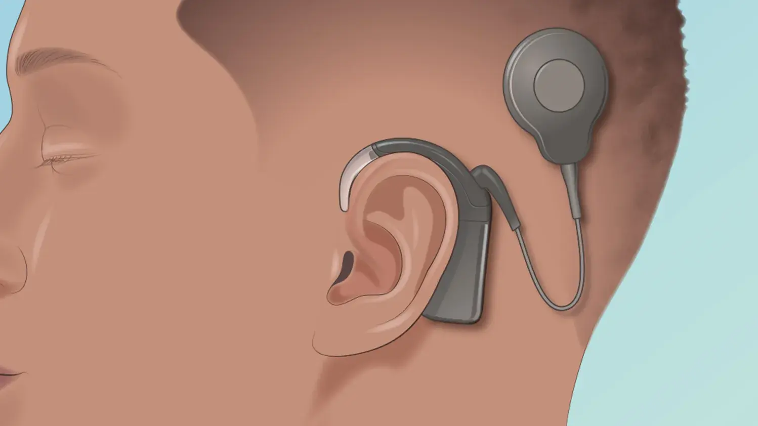 Illustration of patient education example.